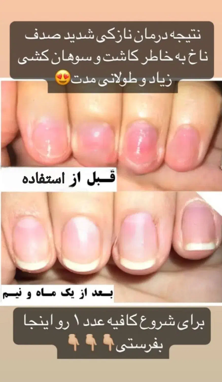 تقویت ناخن|آرایشگاه و سالن‌های زیبایی|مشگین شهر, |دیوار