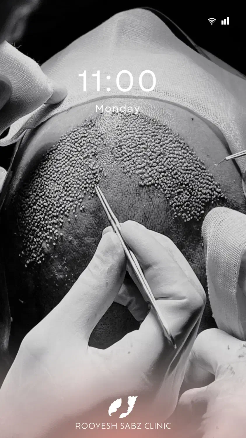 کاشتمو و ابرو|خدمات آرایشگری و زیبایی|تهران, جردن|دیوار