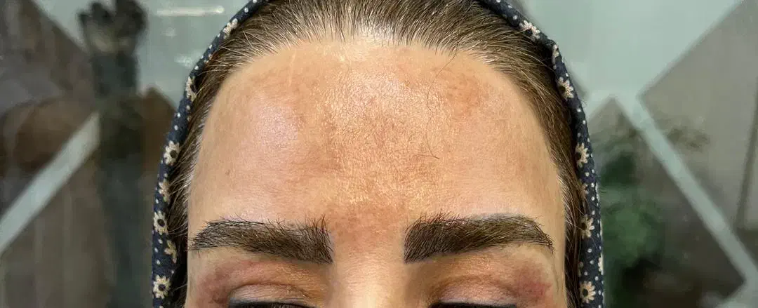 مجهزترین مرکزلیززقم حذف تتوابرو، بدن لک مقاوم صورت|خدمات آرایشگری و زیبایی|قم, بکایی|دیوار