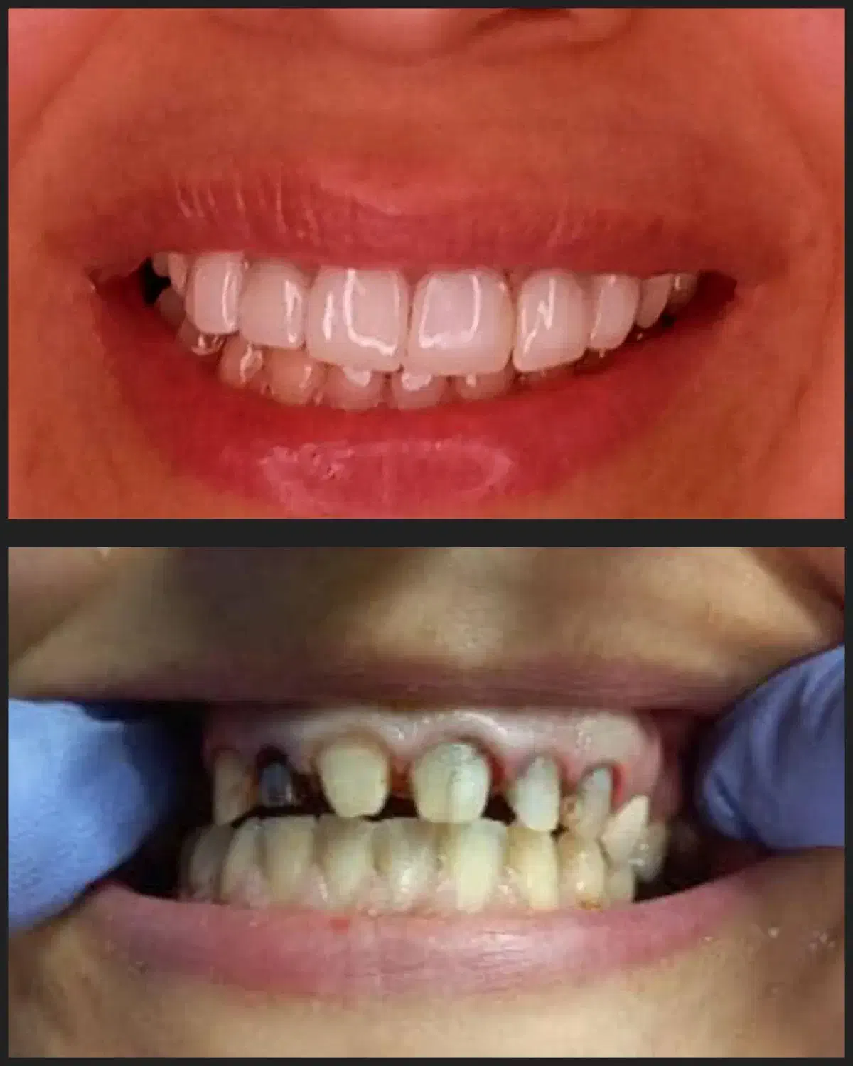 دندانسازی دندان سازی|پزشکی|مشهد, سرافرازان|دیوار