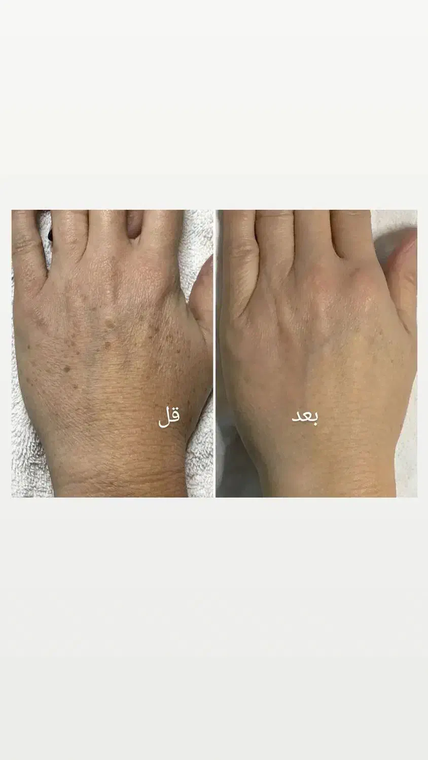 خال|خدمات آرایشگری و زیبایی|سرپل ذهاب, |دیوار