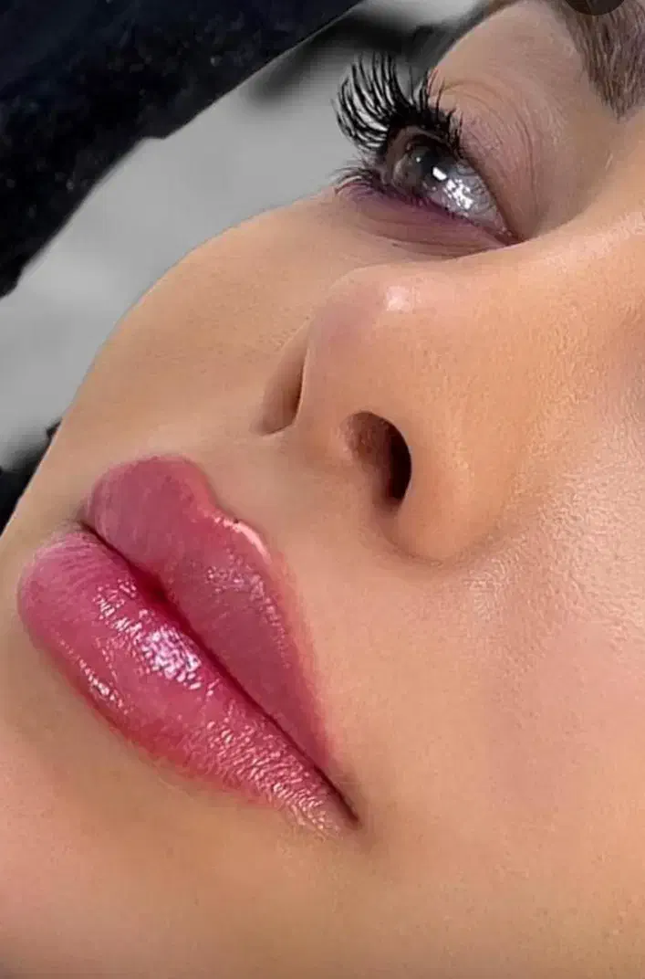 جشنواره ژل لب فیلر زیرچشم،شقیقه،بوتاکس،کلینیک پزشک|خدمات آرایشگری و زیبایی|کرج, گوهردشت|دیوار