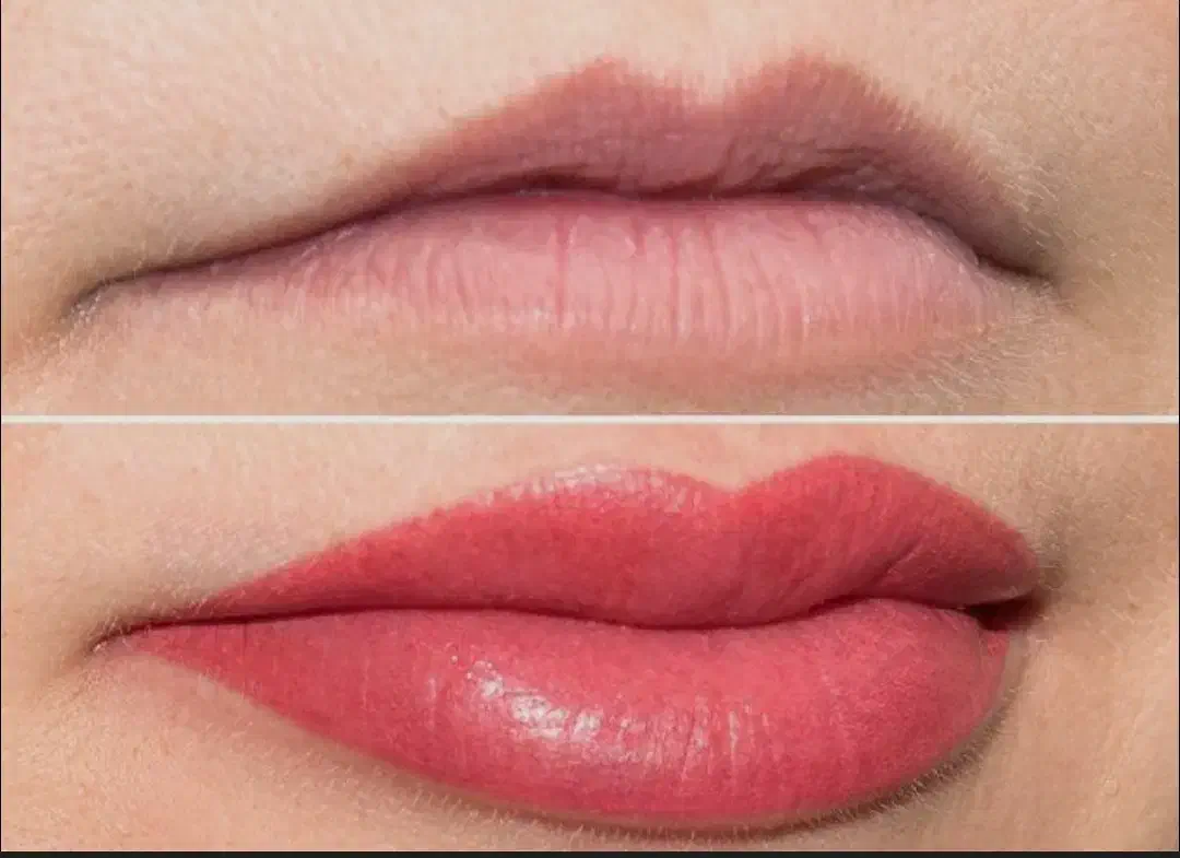 مدل زیبایی داعم صورت رایگان|خدمات آرایشگری و زیبایی|کرج, شهرک علی ابن ابیطالب (کوثر)|دیوار