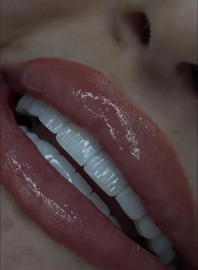 دندانپزشکی اقساطی بدون بهره|خدمات آرایشگری و زیبایی|کرج, کوی کارمندان شمالی|دیوار