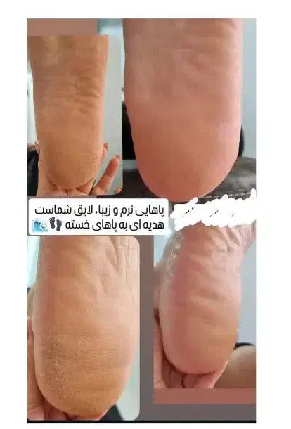 تخفیف لیزرکل بدن فقط۴۵۰ بمناسبت روزمادر تست رایگان|خدمات آرایشگری و زیبایی|زنجان, |دیوار