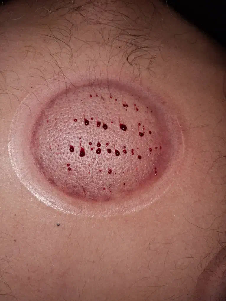 حجامت|خدمات آرایشگری و زیبایی|زاهدان, |دیوار