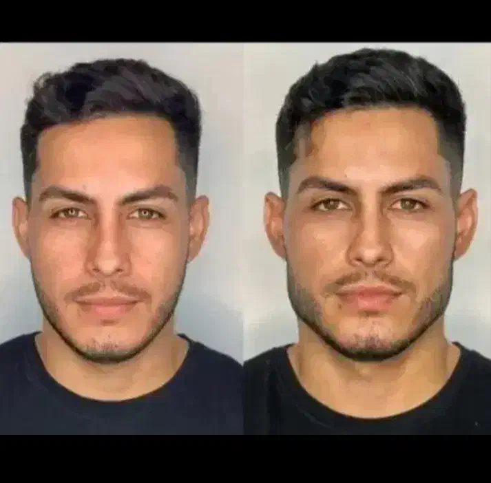 جشنواره ی پاییزه ی فیلر وبوتاکس|خدمات آرایشگری و زیبایی|ارومیه, |دیوار