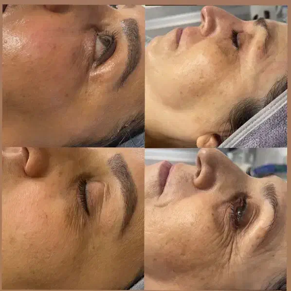 جشنواره لاغری 3تا12سانت در1جلسه وهایفوتراپی vip|خدمات آرایشگری و زیبایی|رشت, پارک شهر|دیوار