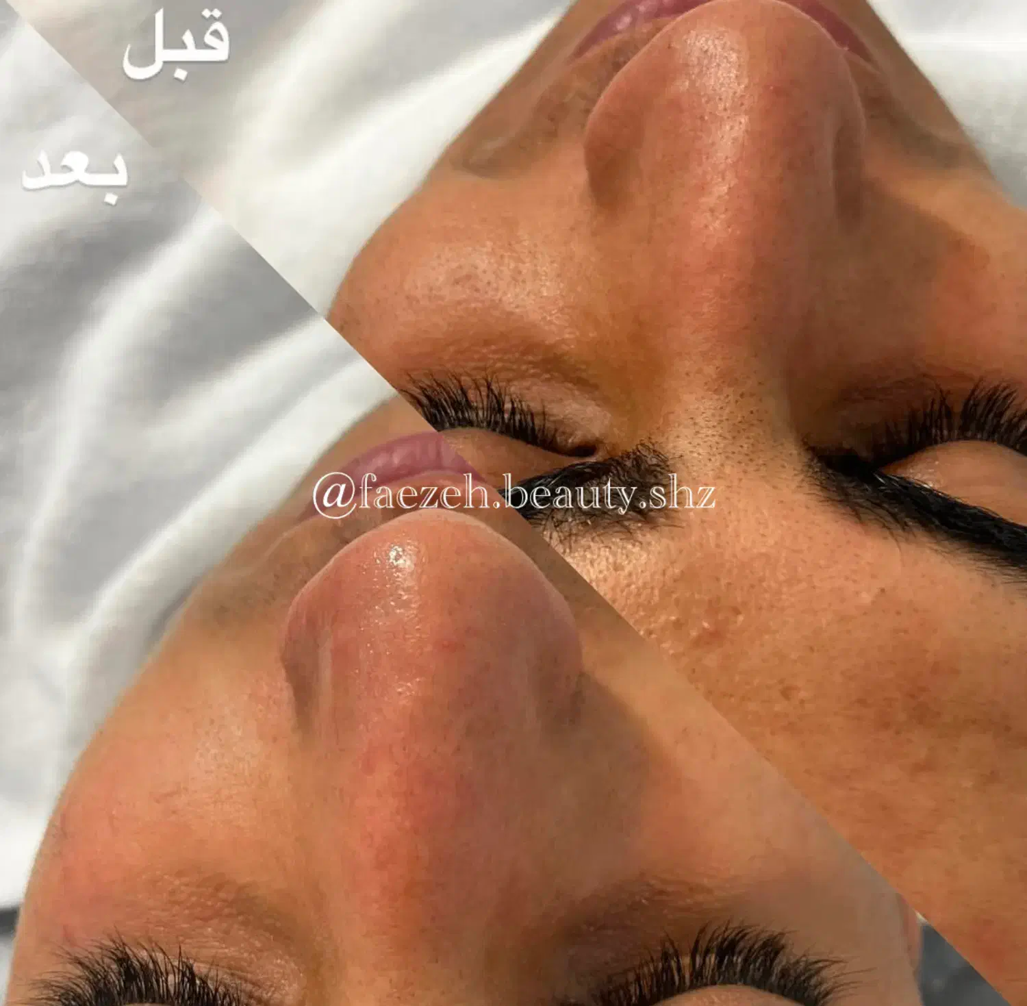 مدل فیشیال با تخفیف بابرند اکلادو|خدمات آرایشگری و زیبایی|شیراز, قالیشویی|دیوار