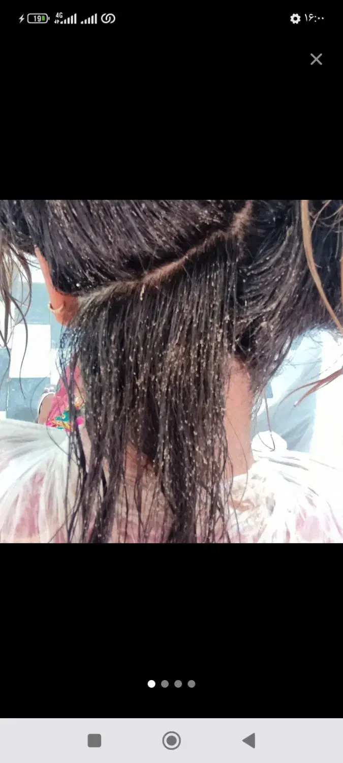 جمع آوری شپش قفط دریک جلسه|آرایشی، بهداشتی، درمانی|نیشابور, رحمت آباد|دیوار