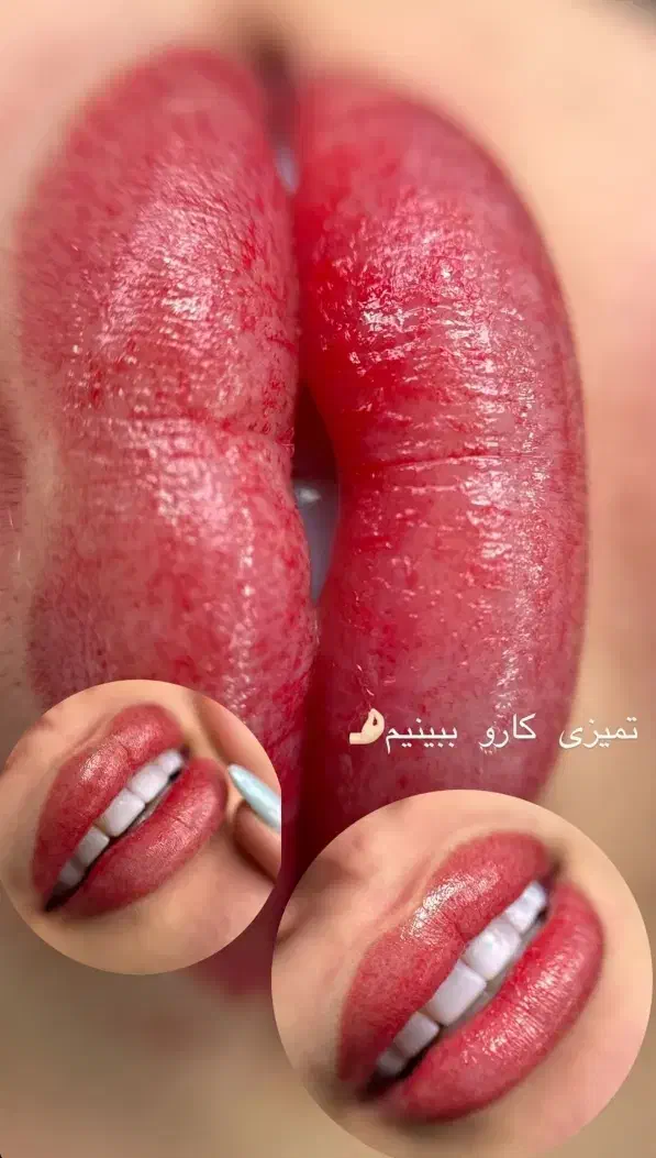 پیگمنتر حرفه ای ،اماده همکاری با سالن ها|استخدام درمانی، زیبایی، بهداشتی|برازجان, |دیوار