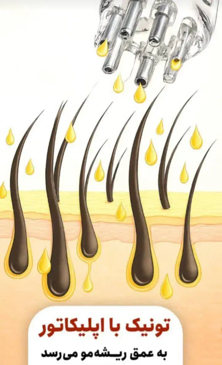 تونیک ضد ریزش و محرک رشد مجدد مو|آرایشی، بهداشتی، درمانی|بابل, |دیوار