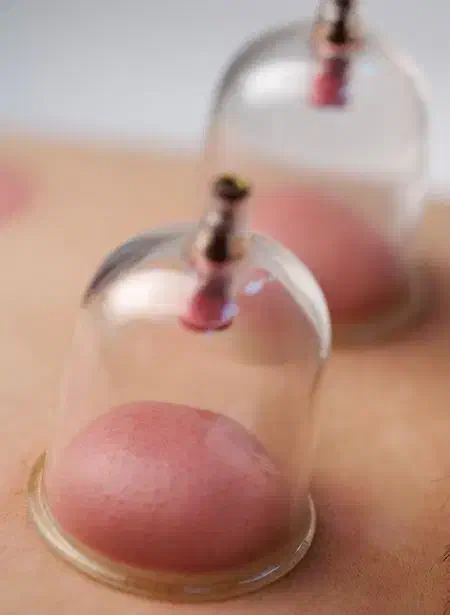 حجامت . بادکشی|خدمات آرایشگری و زیبایی|مشهد, انقلاب|دیوار