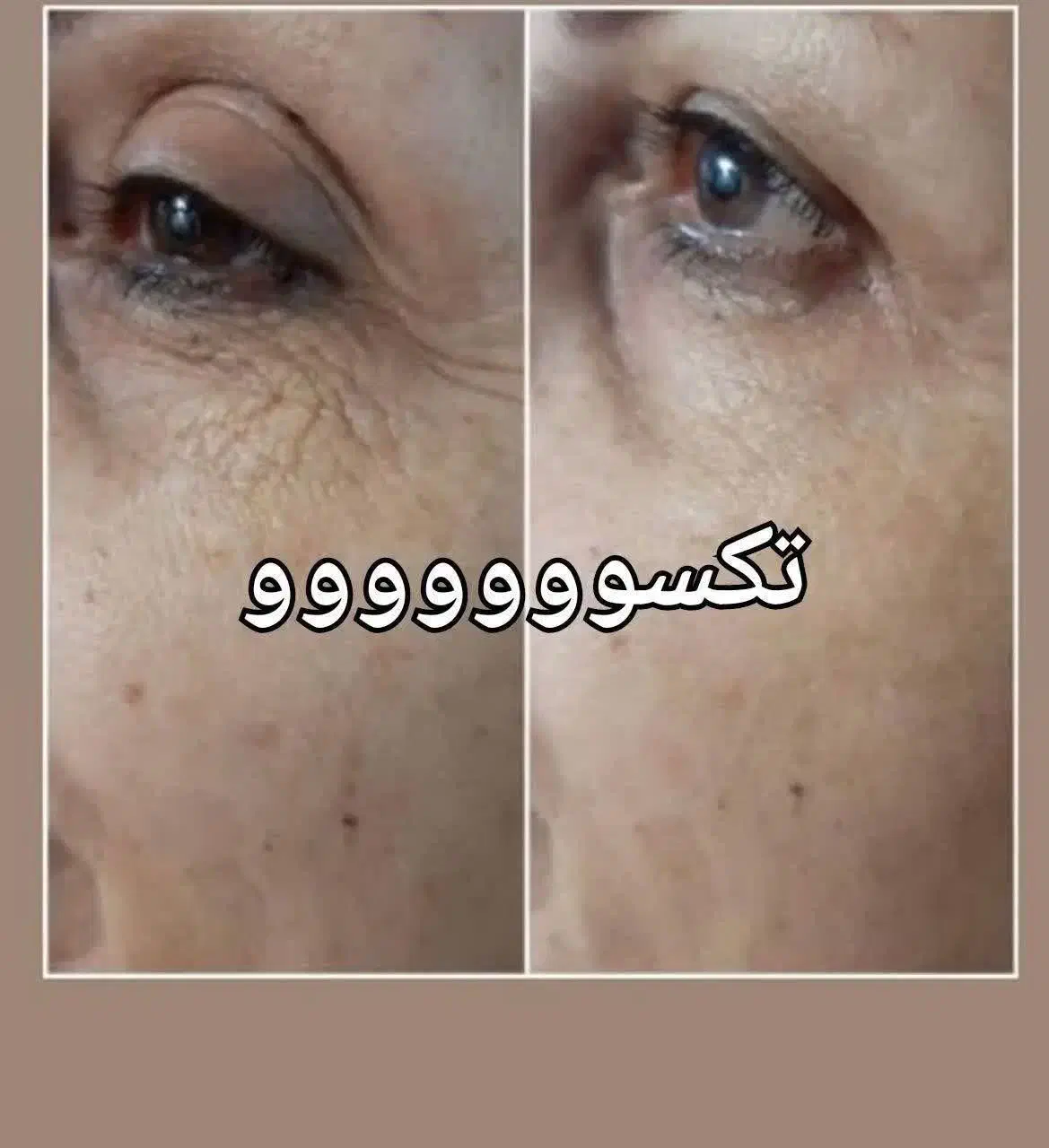 جوان سازی پوست خود را به ما بسپارید|آرایشی، بهداشتی، درمانی|اردبیل, |دیوار