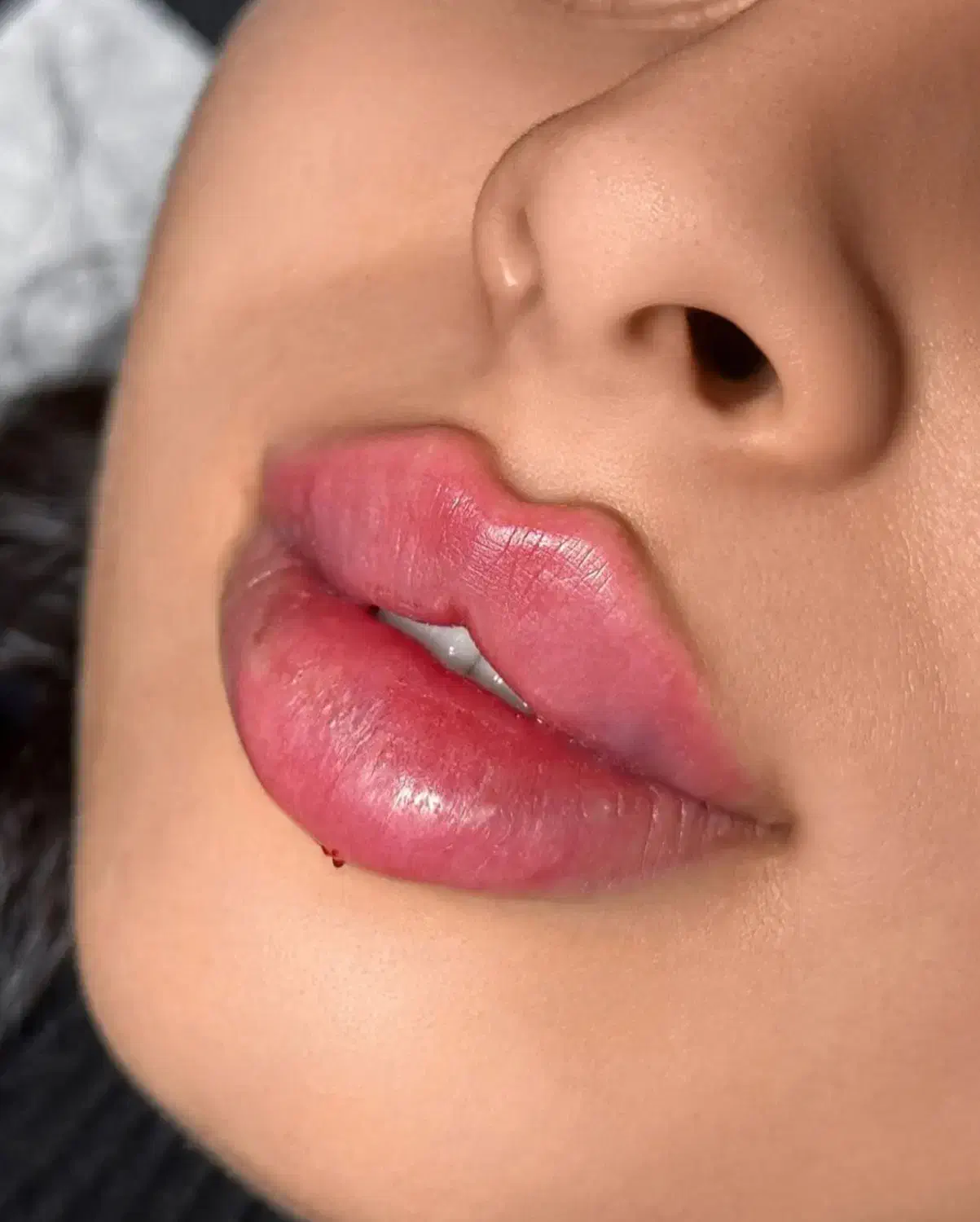 جشنواره تخفیفات ژل و بوتاکس|خدمات آرایشگری و زیبایی|نجف‌آباد, امام خمینی|دیوار