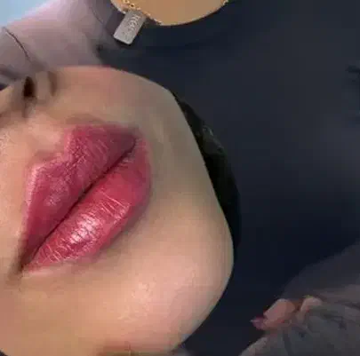 ژل وبوتاکس ومزونیدلینگ وحجامت|خدمات آرایشگری و زیبایی|فولادشهر, B2|دیوار