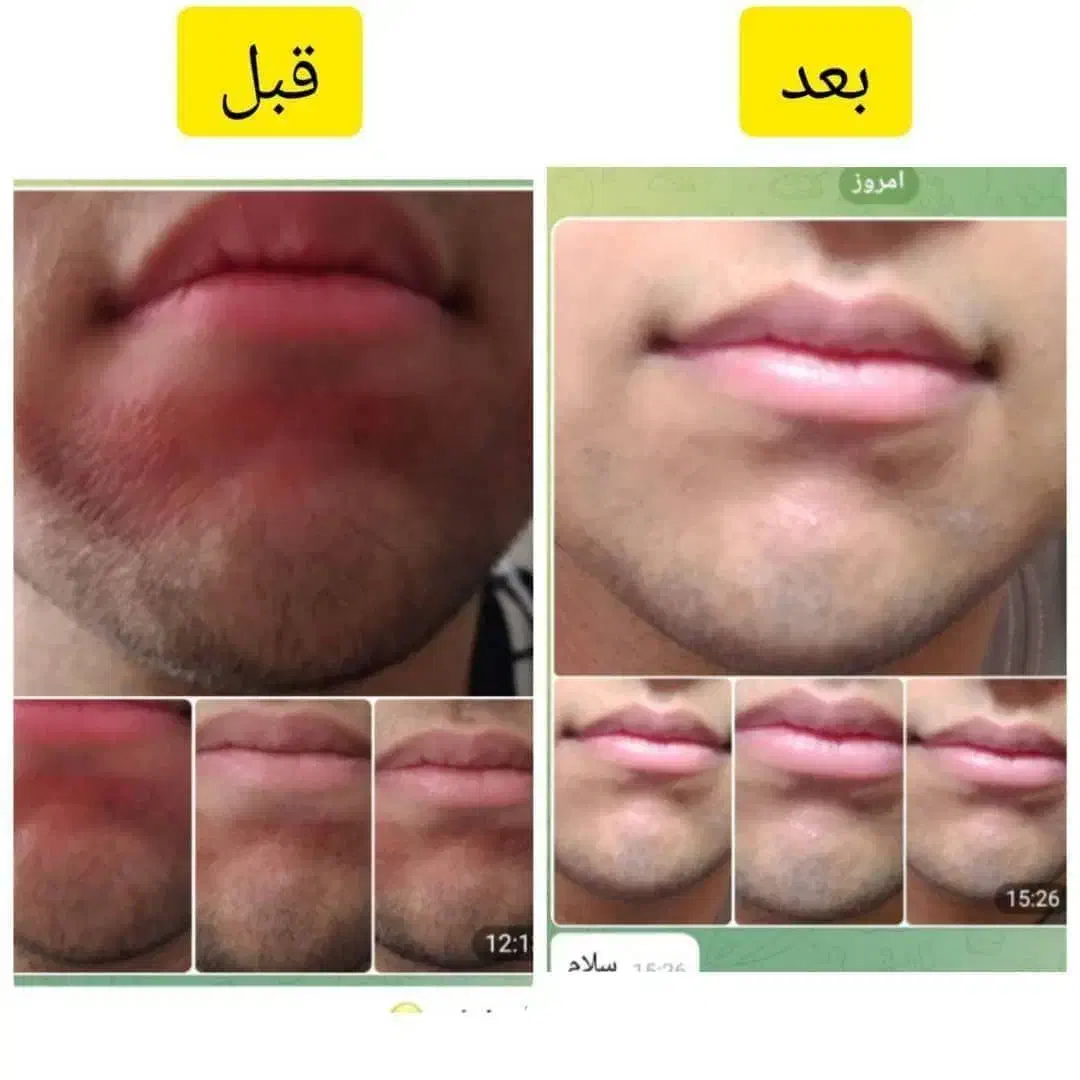 روغن های معجزه گر|خوردنی و آشامیدنی|چابهار, |دیوار