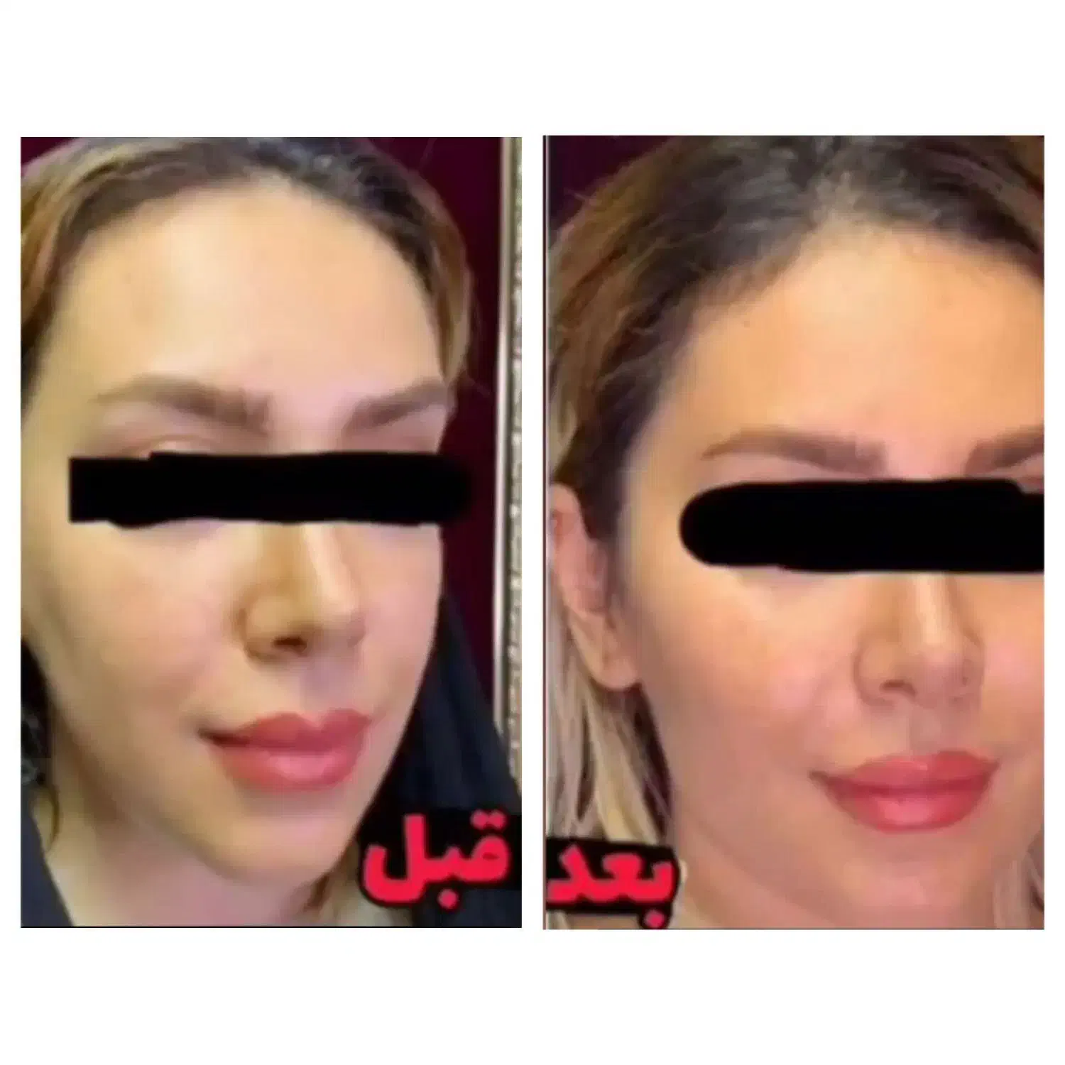 پنکک لاکچری کوین اصل|آرایشی، بهداشتی، درمانی|دورود, |دیوار