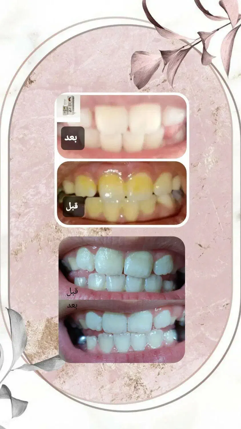 سفیدی دندان تا بوی خوش دهان|آرایشی، بهداشتی، درمانی|تهران, شهید رجایی|دیوار