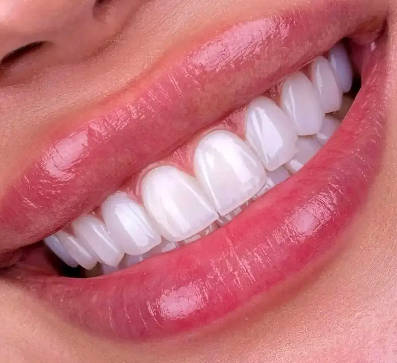 کامپوزیت|خدمات آرایشگری و زیبایی|رشت, گلسار|دیوار