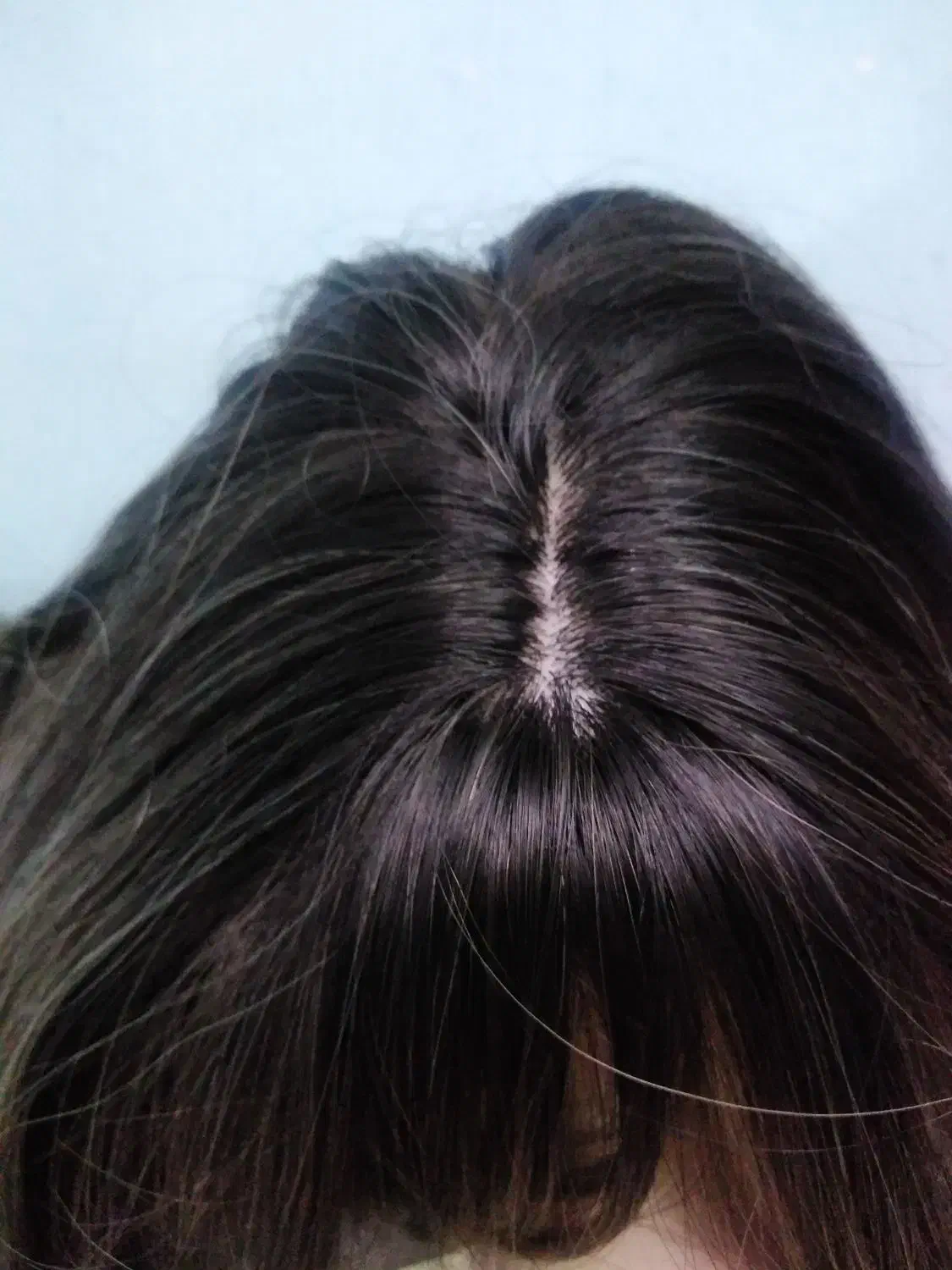 کلاه گیس فرق پوستی|آرایشی، بهداشتی، درمانی|فلاورجان, |دیوار