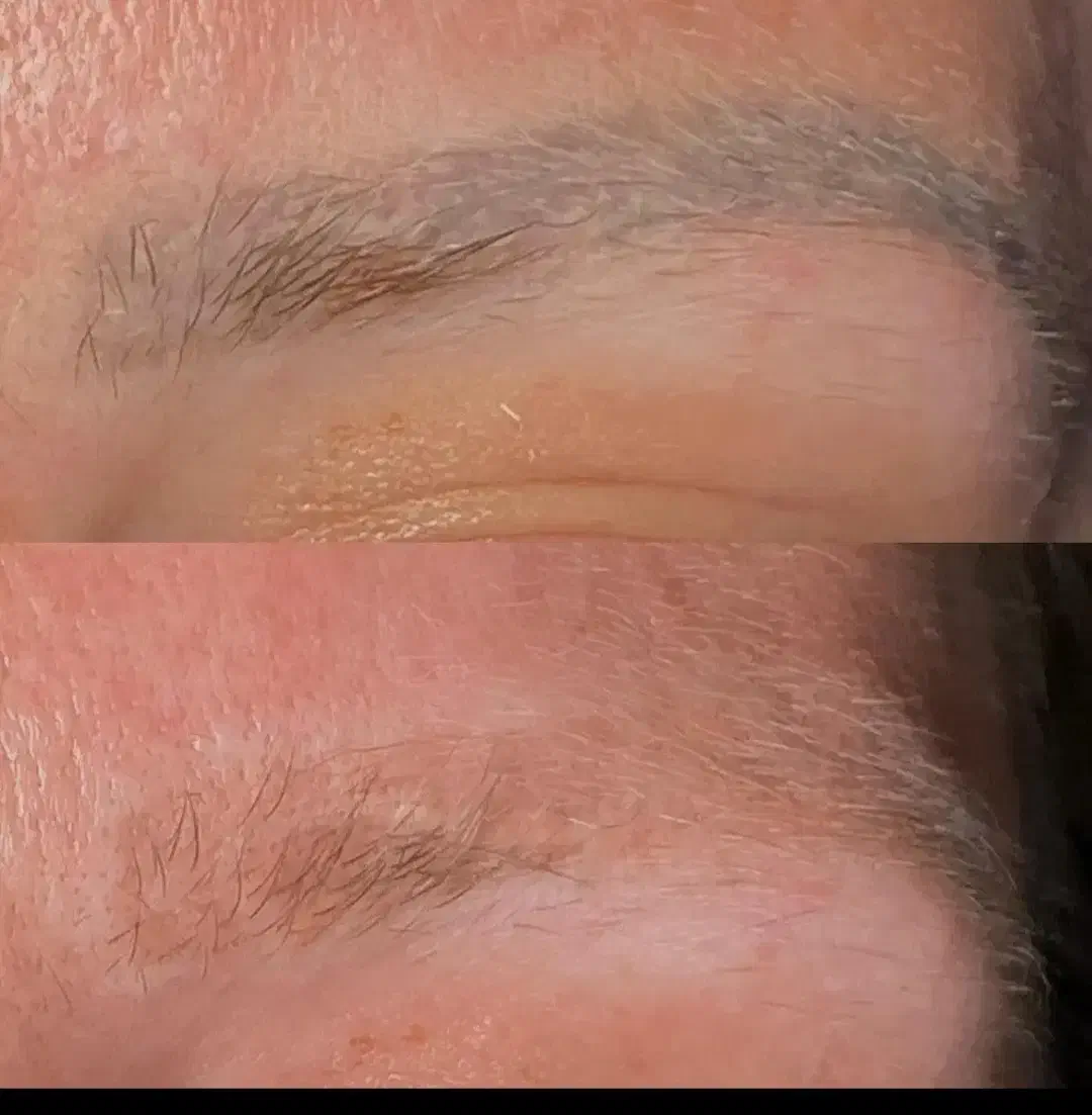 لیزر تتو های قدیمی تتوی صورت و بدن فقط ۵۰۰|خدمات آرایشگری و زیبایی|فولادشهر, C3|دیوار