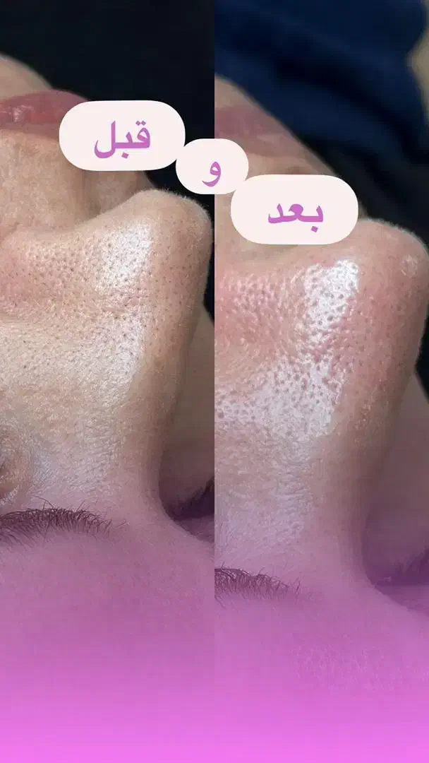 فروش کرم وماسک برندکلینیک|آرایشی، بهداشتی، درمانی|کرمان, |دیوار