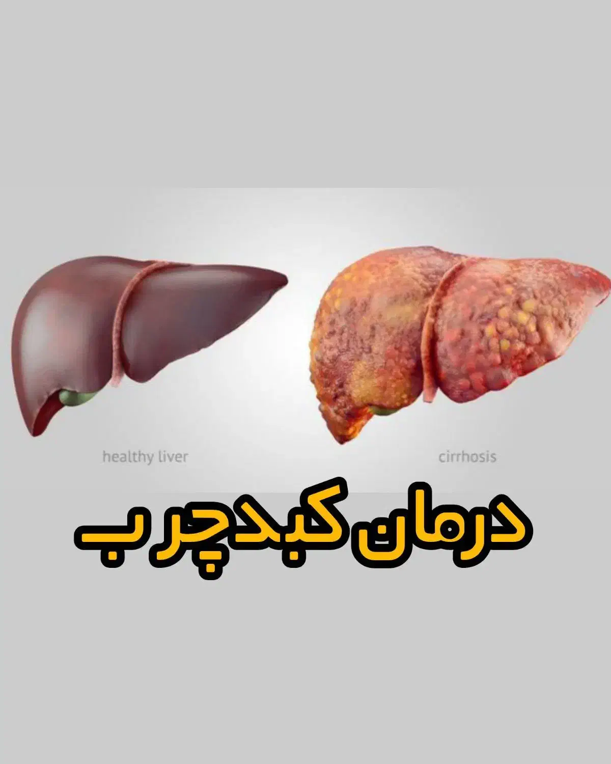 پاکسازی بهبود کبد|آرایشی، بهداشتی، درمانی|اردبیل, |دیوار