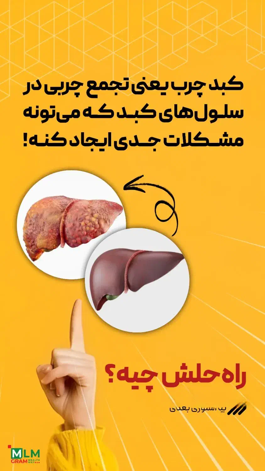 درمان خانگی کبد چرب|آرایشی، بهداشتی، درمانی|سیرجان, |دیوار