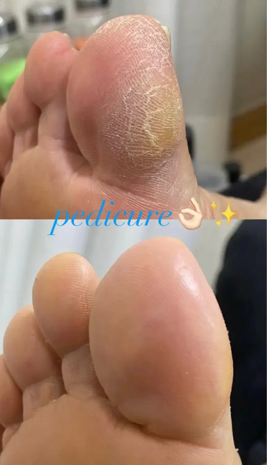 پدیکور با۲۰٪تخفیف|خدمات آرایشگری و زیبایی|ارومیه, |دیوار