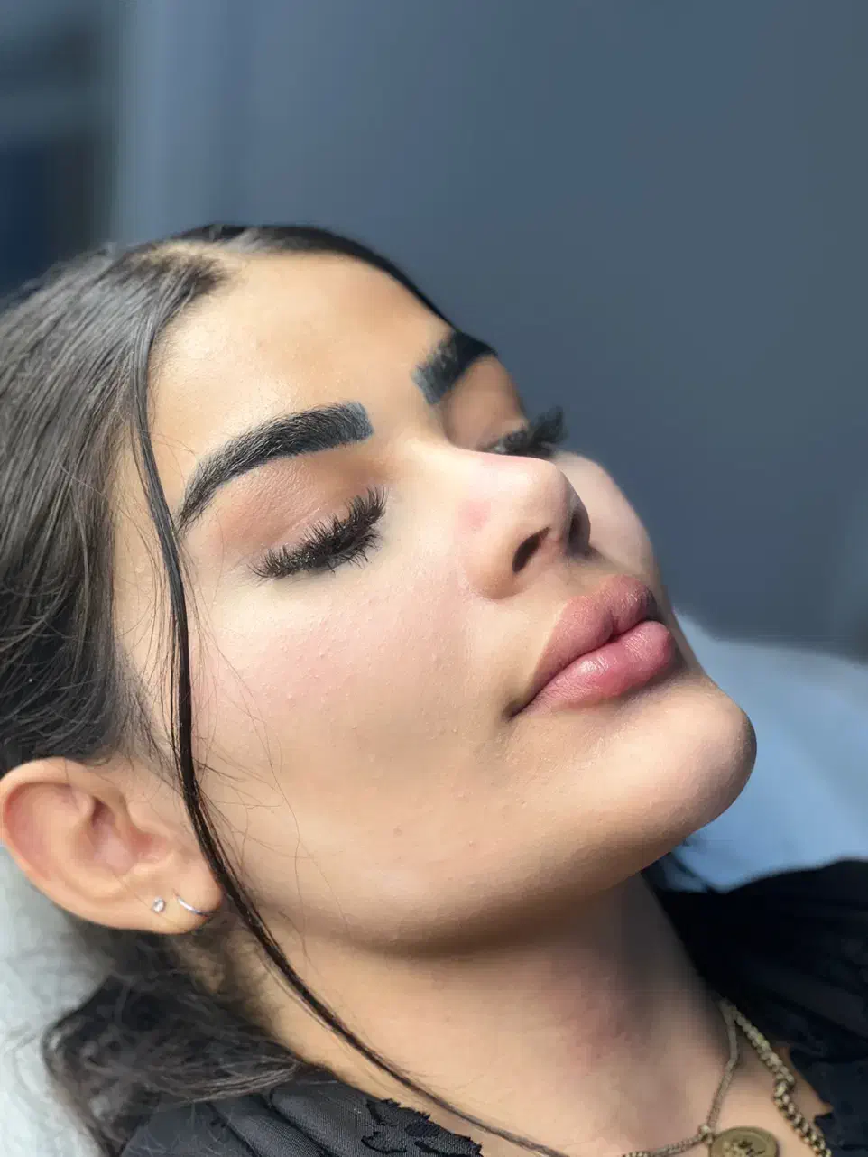 تزریق فیلر برای لب|خدمات آرایشگری و زیبایی|کرج, گلشهر|دیوار