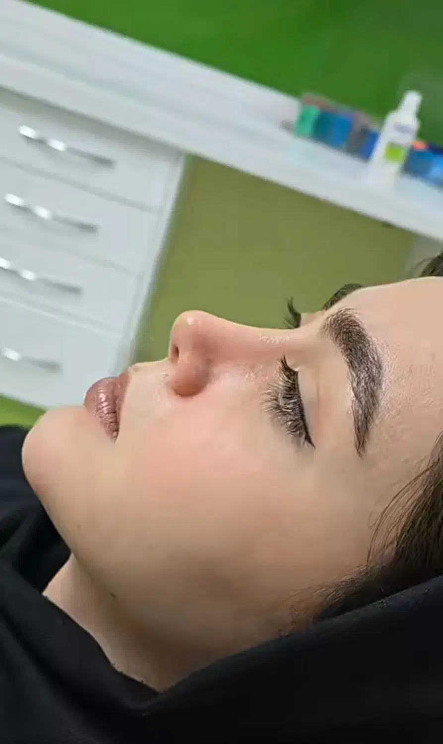 عمل بینی لیفت لیپو ابدو/دایرکت ابرو/رفع غبغب/کاشت|خدمات آرایشگری و زیبایی|کاشان, امیرکبیر|دیوار