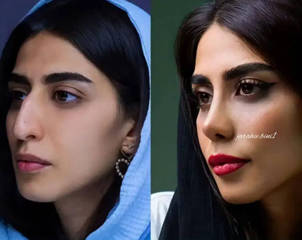 عمل و جراحی بینی 23تا25 میلیون /مشاوره رایگان|خدمات آرایشگری و زیبایی|کرج, عظیمیه|دیوار