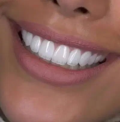 دندانپزشکی  تخصصی ترین مرکز ایمپلنت و جراحی|خدمات آرایشگری و زیبایی|ورزقان, |دیوار