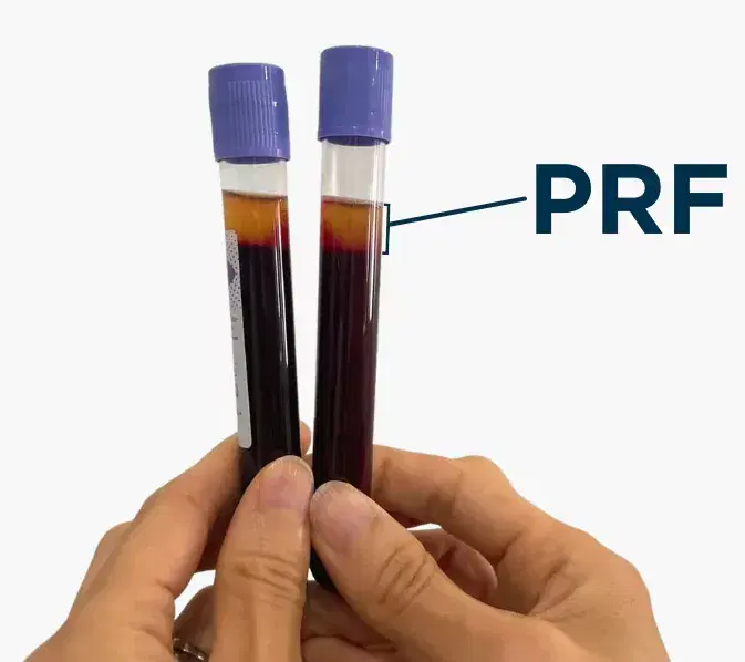 تخفیفات ویژه پی آر اف(PRF) پی ار پی|خدمات زیبایی و سلامت|شیراز, چوگیاه|دیوار