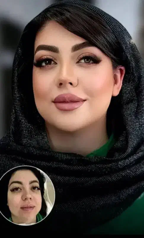 آموزش وخدمات ژلوبوتاکس.پرسینگ.حجامت.زالو.پرستاری|خدمات آرایشگری و زیبایی|پرند, فاز ۲|دیوار