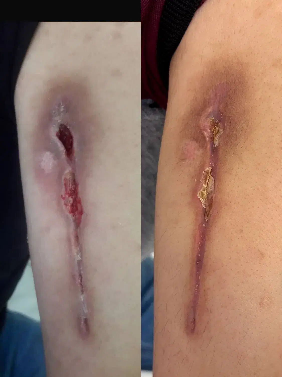 کلینیک تخصصی درمان انواع زخم(بستر و دیابت) فردوس|خدمات آرایشگری و زیبایی|اصفهان, محله سفلی|دیوار