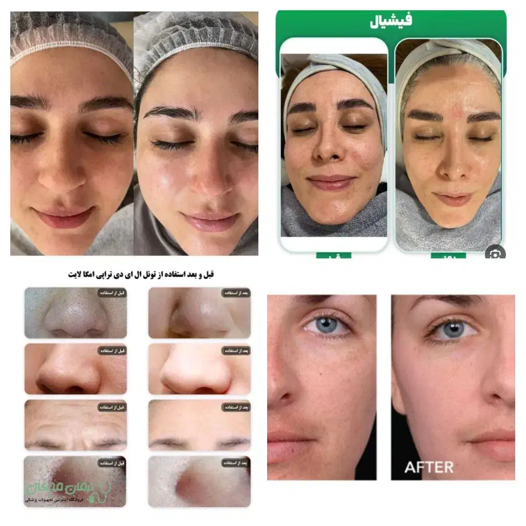 ملکه زیبایی|خدمات آرایشگری و زیبایی|سراوان, |دیوار