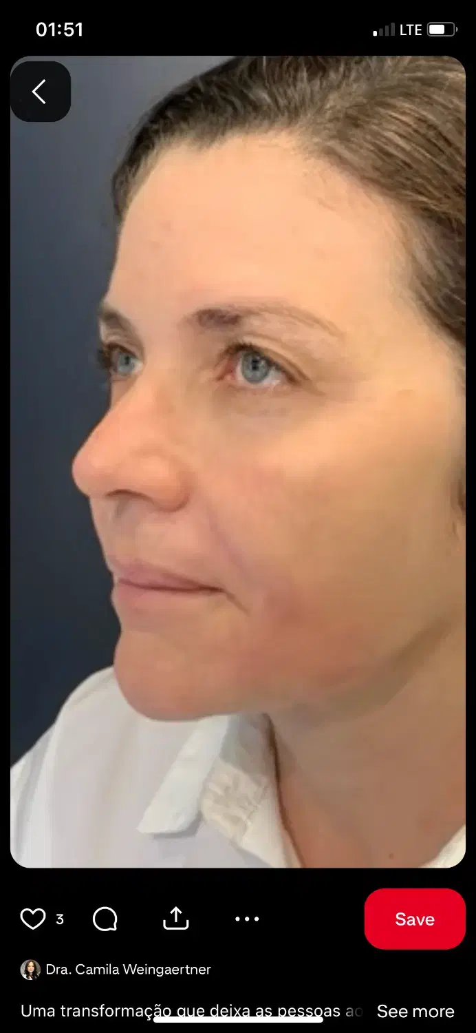 جشنواره تخفیف جراحی لیفت صورت|خدمات آرایشگری و زیبایی|کرج, مهرویلا جنوبی|دیوار