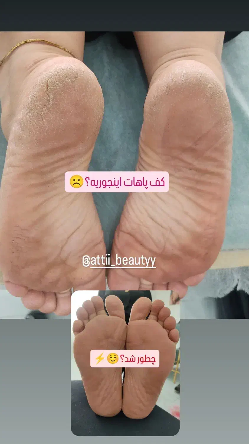پدیکور وکف سابی و پارافین تراپی|خدمات آرایشگری و زیبایی|هشتگرد, هشتگرد قدیم|دیوار