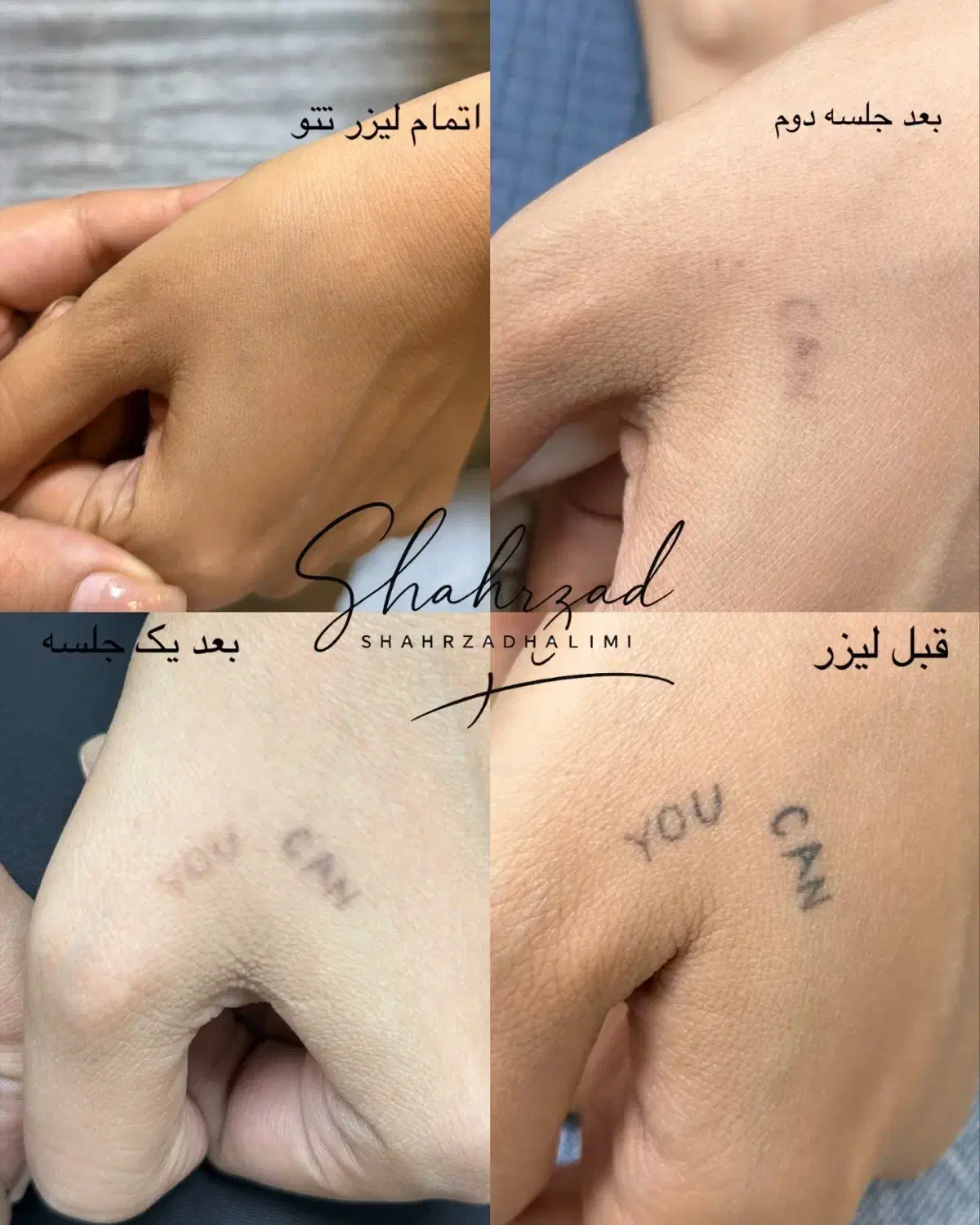 اجاره ورنت لیزر کیوسوییچپیکوشور بااپراتور حرفه ای|پزشکی|تهران, اقدسیه|دیوار