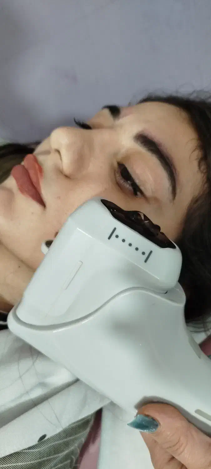 جشنواره یلدایی هایفو تراپی|خدمات آرایشگری و زیبایی|کوهدشت, |دیوار