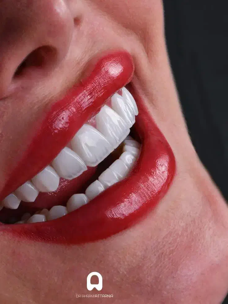 ثبت نام (مهلت آخر) دوره دستیار دندانپزشک در مریوان|خدمات آموزشی|مریوان, |دیوار