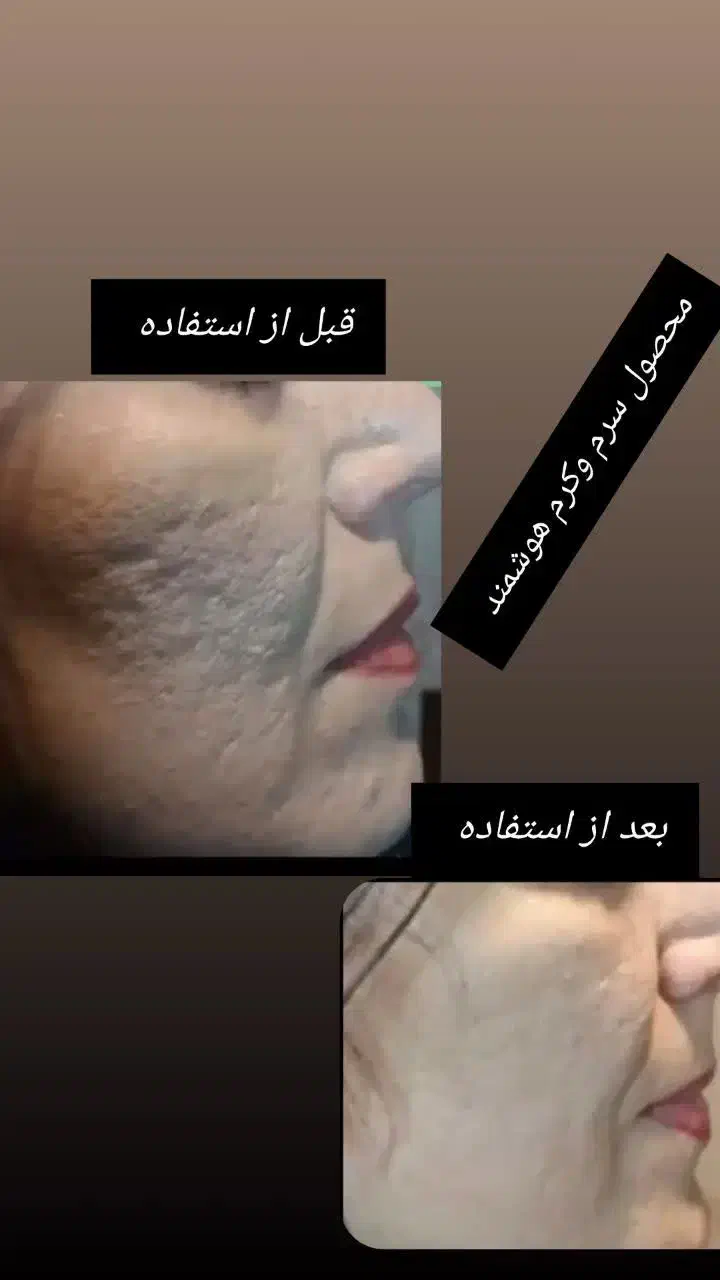 مشاور پوست و مو لیاتیم|آرایشی، بهداشتی، درمانی|اصفهان, باغ زرشک|دیوار
