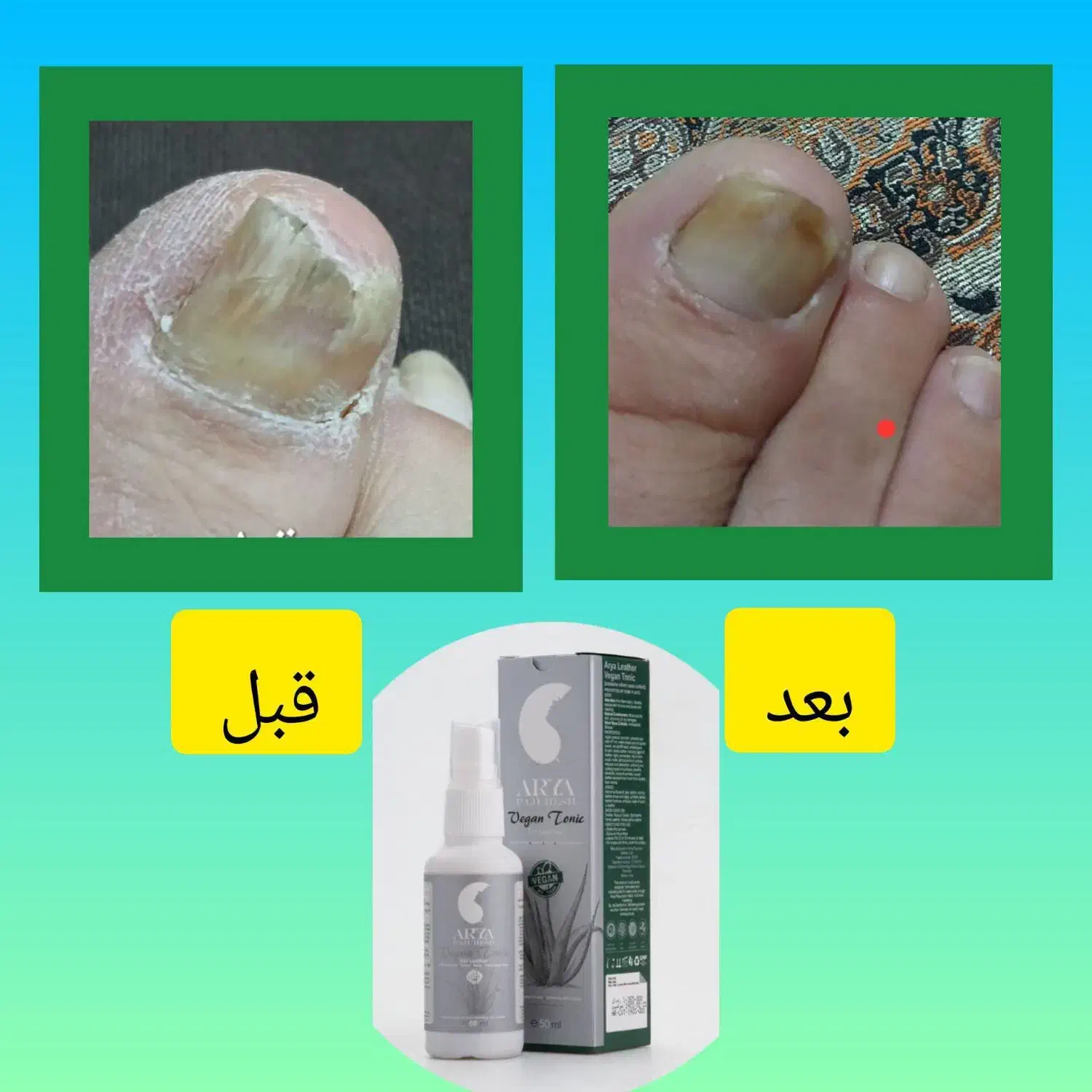 درمان ترک پا ومیخچه|آرایشی، بهداشتی، درمانی|تربت‌حیدریه, داروپخش|دیوار