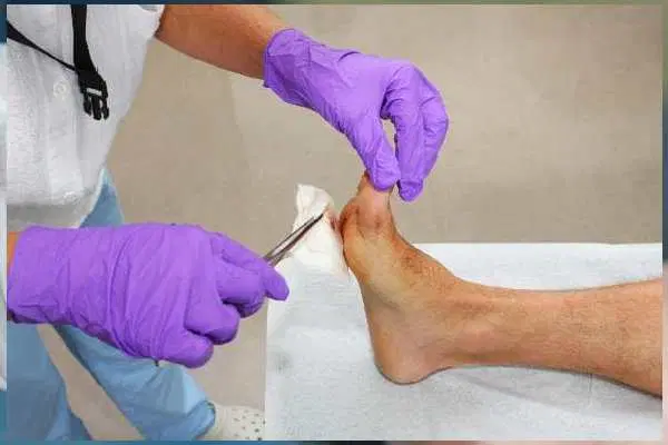 زخم . پای دیابتی . زخم بستر پانسمان نوین|خدمات زیبایی و سلامت|تبریز, |دیوار