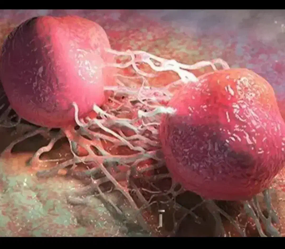 پروستات ومشکلات اقایان|آرایشی، بهداشتی، درمانی|میاندوآب, |دیوار