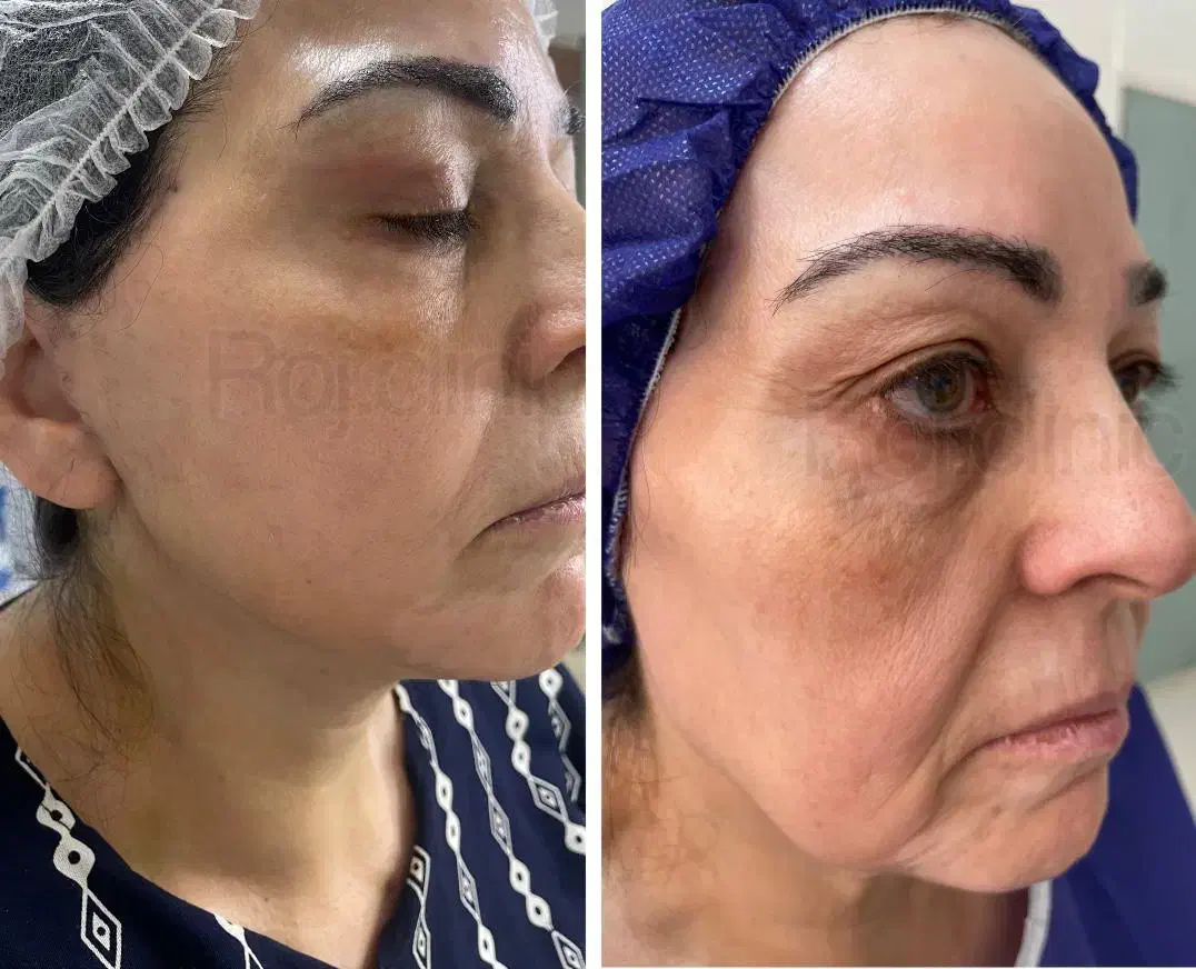 تخفیف مشاوره خدمات زیبایی وجراحی صورت  بدن|خدمات آرایشگری و زیبایی|تهران, میدان ولیعصر|دیوار