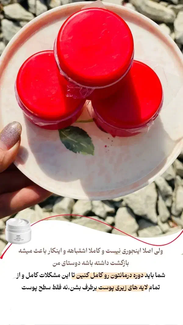 کرم|آرایشی، بهداشتی، درمانی|رودخانه, |دیوار