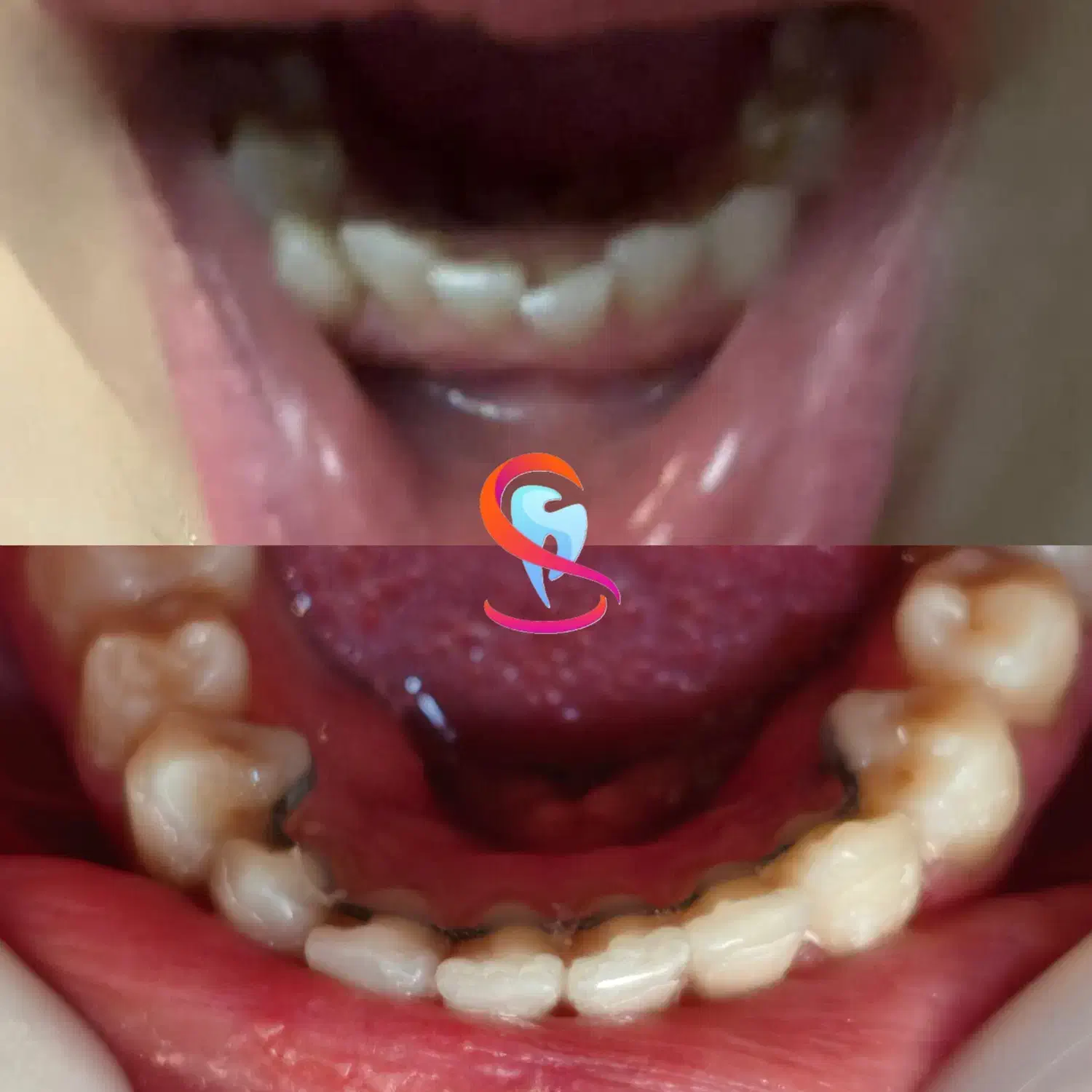 کاشت ایمپلنت و خدمات درمانی و زیبایی دندانپزشکی|خدمات آرایشگری و زیبایی|اصفهان, مهرآباد|دیوار